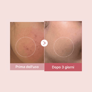 medicube PDRN PINK COLLAGEN CAPSULE CREAM Kimochi